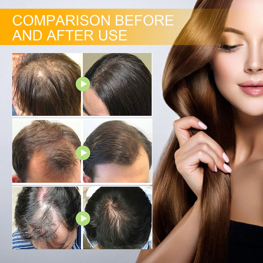 Ginger & Biotin Hair Growth Serum Spray