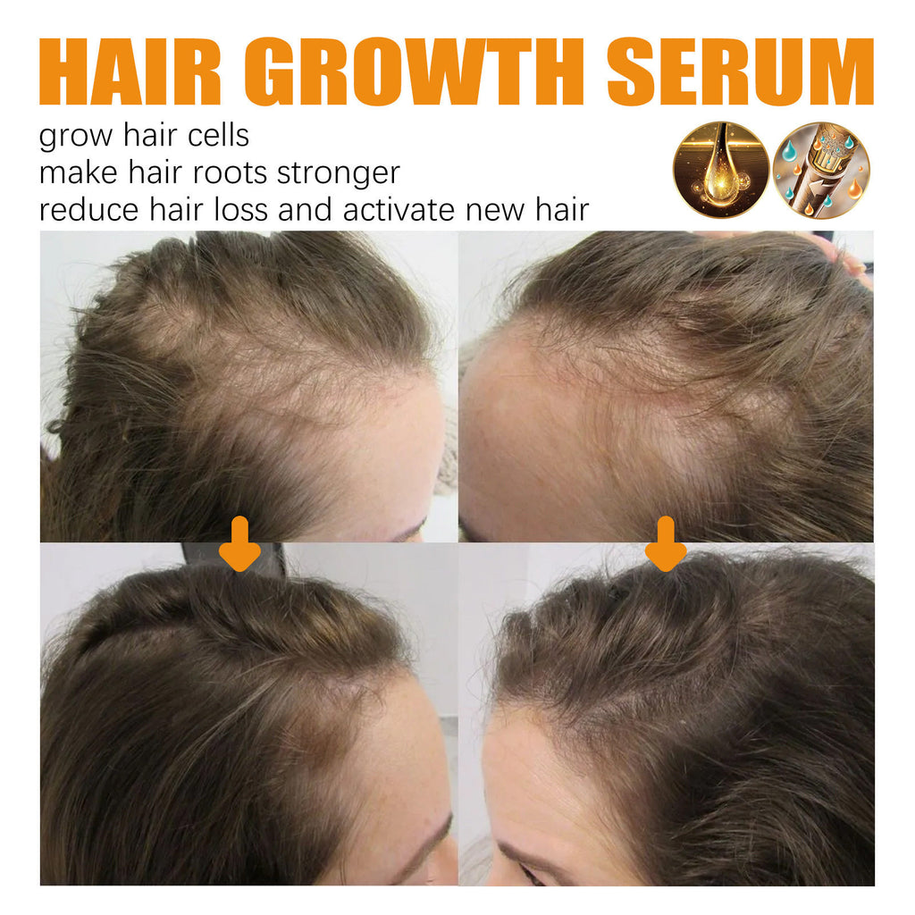 Ginger & Biotin Hair Growth Serum Spray